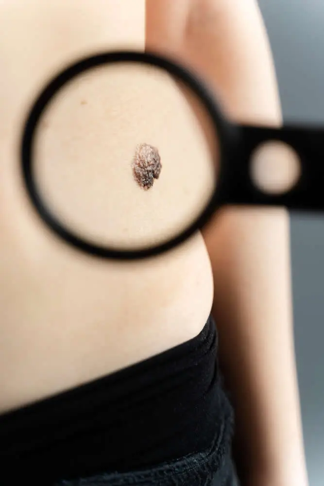happy mature woman close-up-magnifying-glass-mole